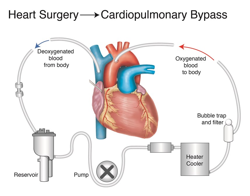 Liverpool Heart and Chest Hospital Heart Surgery